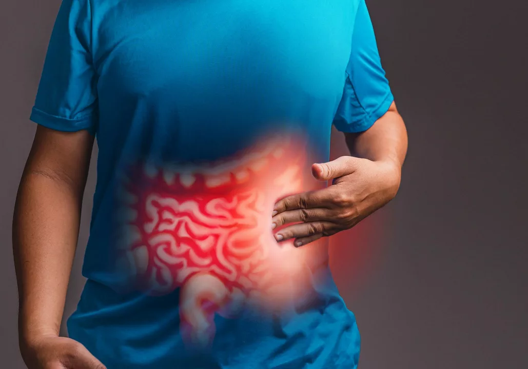 The Link Between Hemorrhoids and Irritable Bowel Syndrome (IBS)